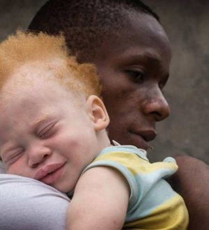 ТОП-10 трагических фактов про людей-альбиносов в Африке