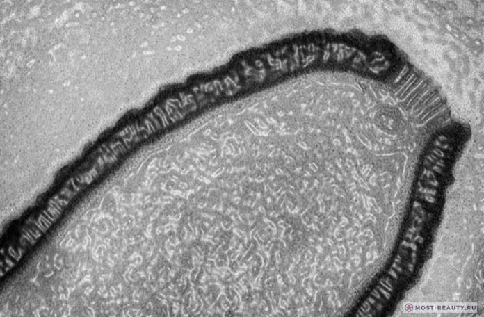 Удивительные и необычные вирусы: Гигантский Сибирский вирус