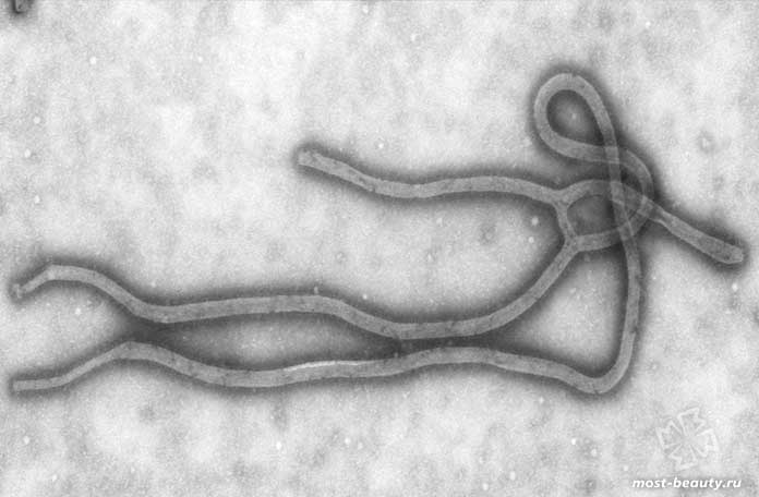 Теории заговора о происхождении болезней: Эбола. CC0
