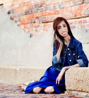 Самые худые люди в мире